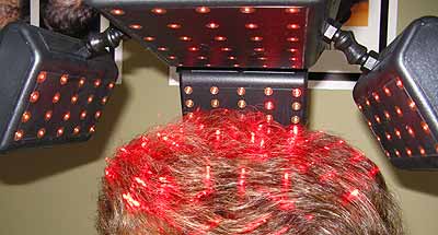 Laser hair treatment